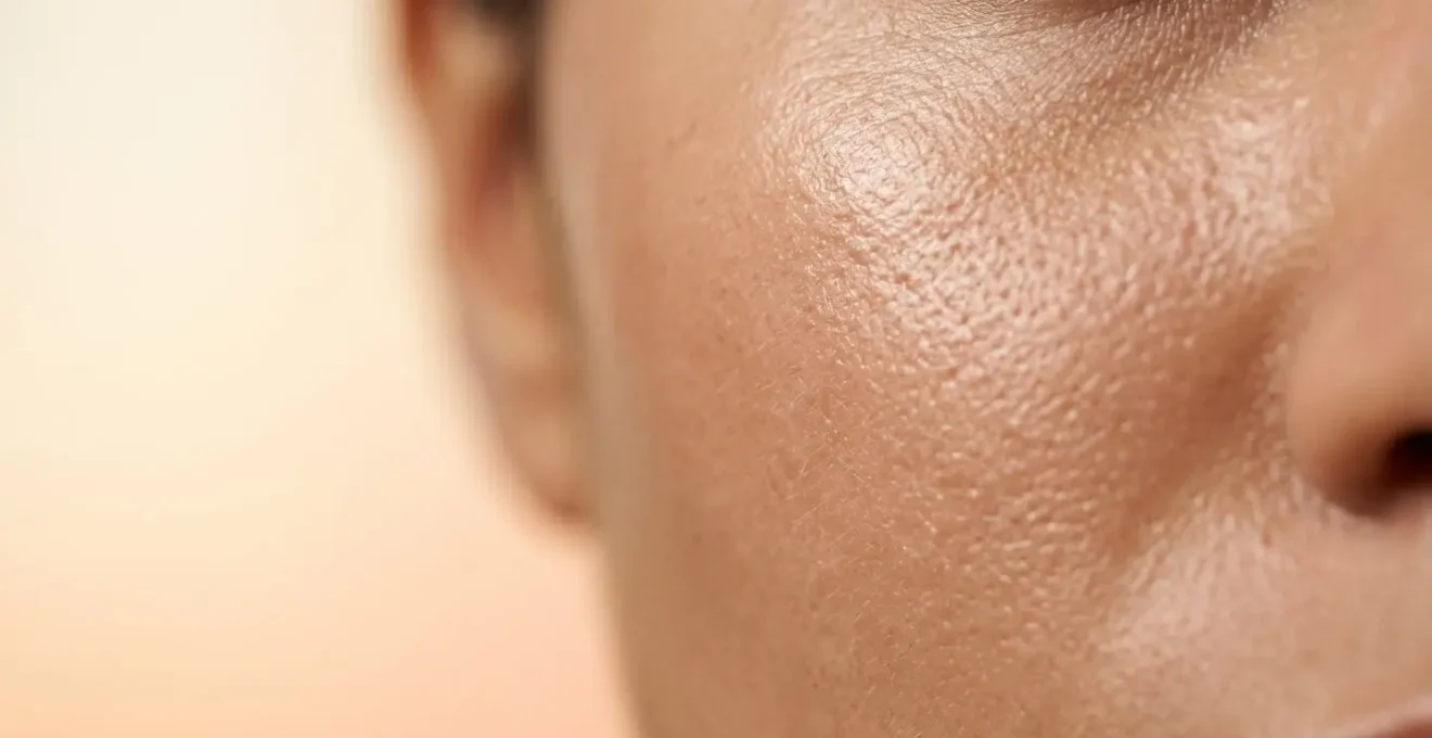 Primer plano de piel facial radiante con textura suave y uniforme tras exfoliación química suave
