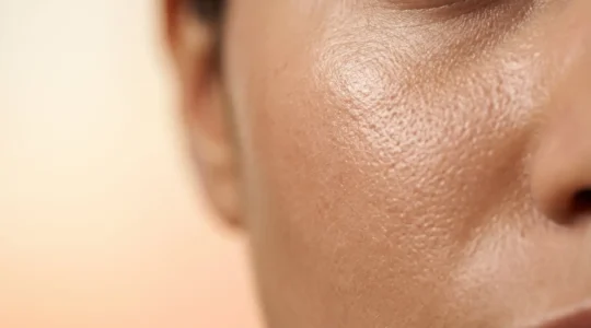 Primer plano de piel facial radiante con textura suave y uniforme tras exfoliación química suave